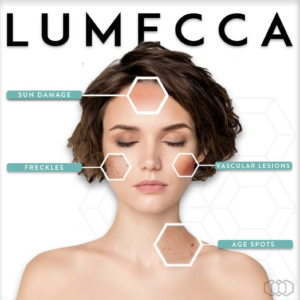 Lumecca treats the appearance of age spots, vascular lesions, rosacea, freckles, and sun damage, encompassing both red and brown lesions.